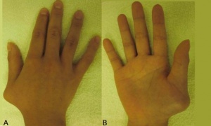 �������