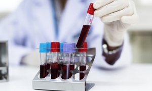 ��� �� ������� ������������?