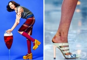 10 модела с физически несъвършенства, които са ослепителни