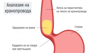 �������� �� ��������