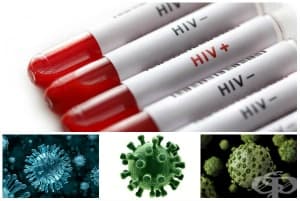 Болест, предизвикана от HIV, с прояви на други вирусни инфекции