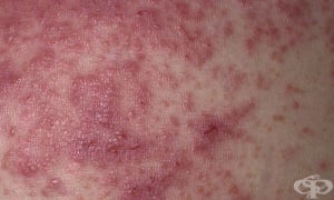 ���������� �������������