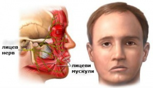 Клоничен хемифациален спазъм