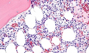 ��������������� ��������