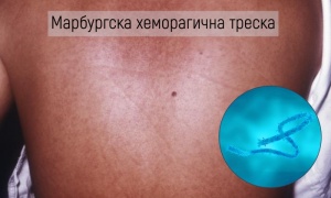 ������� ������ Marburg