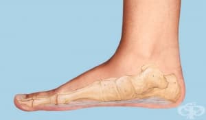 ������ ������� [pes planus] (���������)