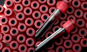 ������ ���� ���� �� ������� ��������� �� ��� �� �������, �������� �� HPV