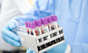 FDA одобри кръвен тест за диагностициране болест на Алцхаймер