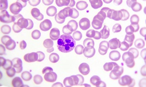 ������������, ����� ����������� ������� CCL3, ��������� ���������� �� ���