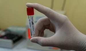 След 2-годишно разследване: Ясни са последствията и научените уроци от пандемията от COVID-19
