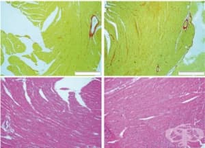 Вродени нарушения в синтеза на колаген