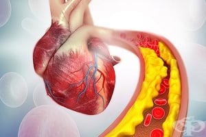 Рискът от инфаркт в България е голям и за млади, и за възрастни – учените отговарят защо