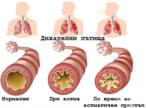Симптоми при астма