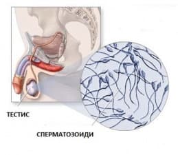 Безплодие при мъжа