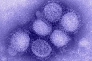 ��� ������ �� ��������� � ����� ������ ����� A(H1N1)?