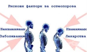 Рискови фактори за остеопороза