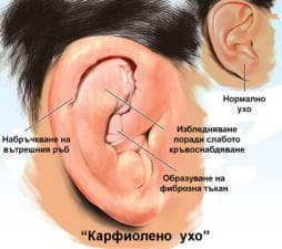 Травма на външното ухо при спортисти