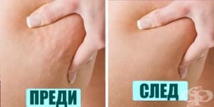 Тренировка за намаляване на целулита по бедрата