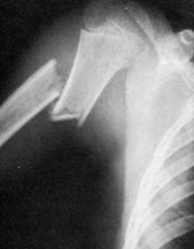 ���������� ���������� �� ��������� ����