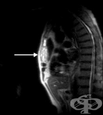 ��� �� ������ ����