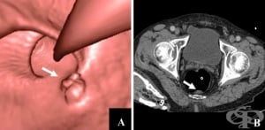 ����������-����������� ������������ (��������� ������������)