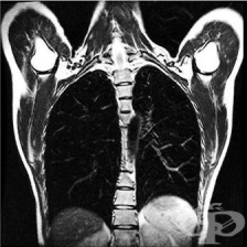 ��� �� ������ �������