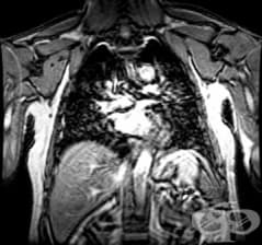 ��� �� ������ ���