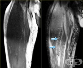 ��� �� �������