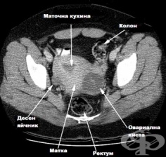 ��� �� ���