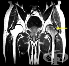 ��� �� ����������� �����