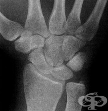 ���������� ���������� �� �������