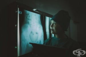 Рентгеново изследване (рентгенография) на корем