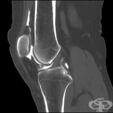 Артрограма