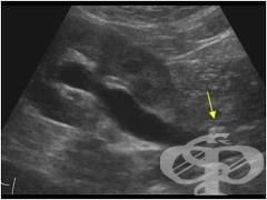 ������������ ���������� (���������) �� ��������� ������