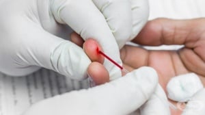 ���������� (Hct)