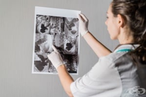 Рентгеново изследване на горния отдел на стомашно-чревния тракт