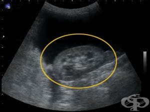 ������������ ���������� (���������) �� �������