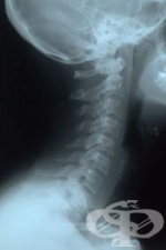 ���������� ���������� �� �����