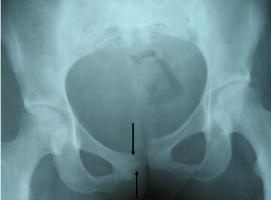 ���������� ���������� �� ������