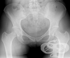 ���������� ���������� �� ����