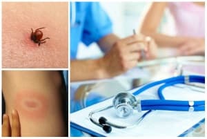 ������� ��� ������� ������ (���������)