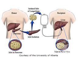 �������������� �� �������� ������