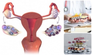 ������� ��� ������������ �������