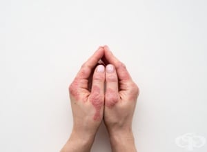 ������� ��� ���������