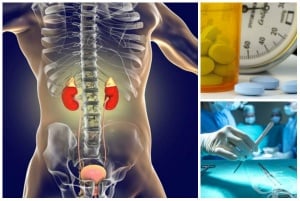 ������� �� �������������