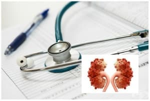 ������� ��� �������� ����������� (����������� �� ���������)