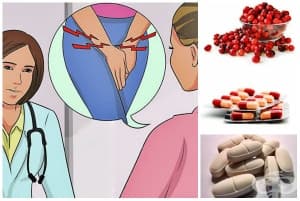 Лечение при цистит