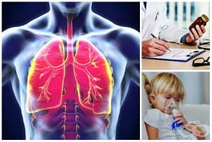 ������� ��� ������������� (�������� �������)