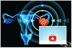 ������� ��� ��������� �������� (��� �� ���������)