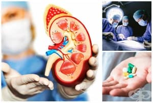 ������� ��� ��� �� ������� (�������� ��������)